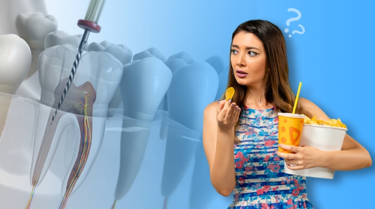 What to Eat After Root Canal Treatment